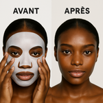 Load image into Gallery viewer, Masque au collagène - Anti taches, bouton, visage gras (PROMO FÊTE DES MÈRES - Stock presqu'épuisé)