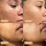Load image into Gallery viewer, Masque au collagène - Anti taches, bouton, visage gras (PROMO FÊTE DES MÈRES  - Stock presqu'épuisé)
